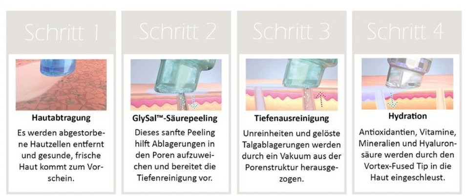 AquaPeeling München